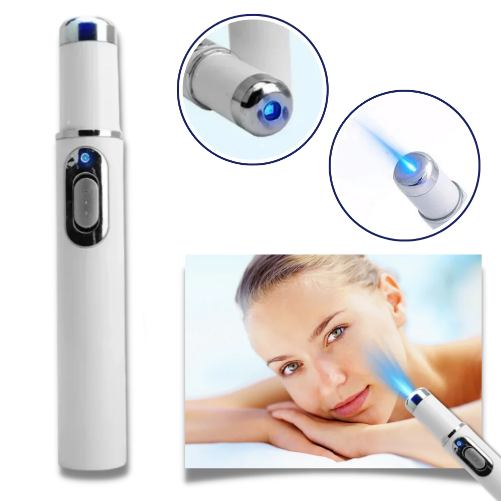 Draagbare Lasertherapie voor een Stralende Teint - Image 3