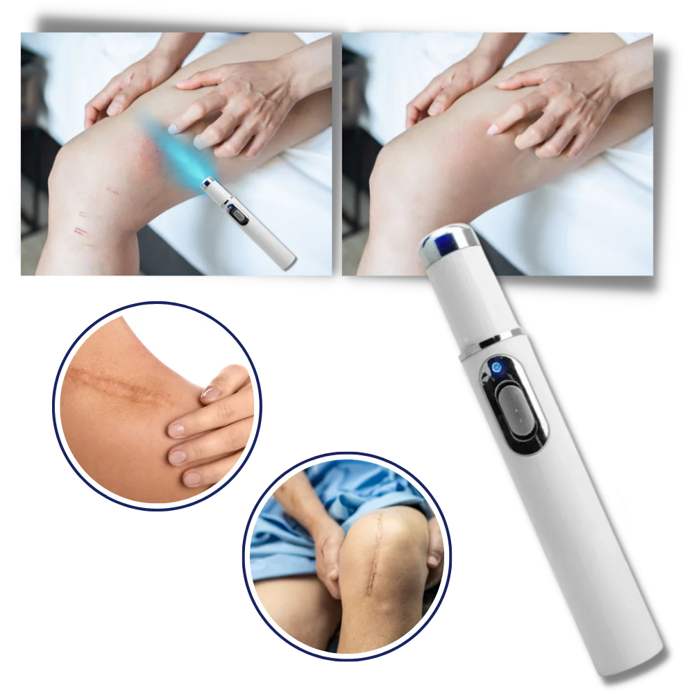 Draagbare Lasertherapie voor een Stralende Teint - Image 4