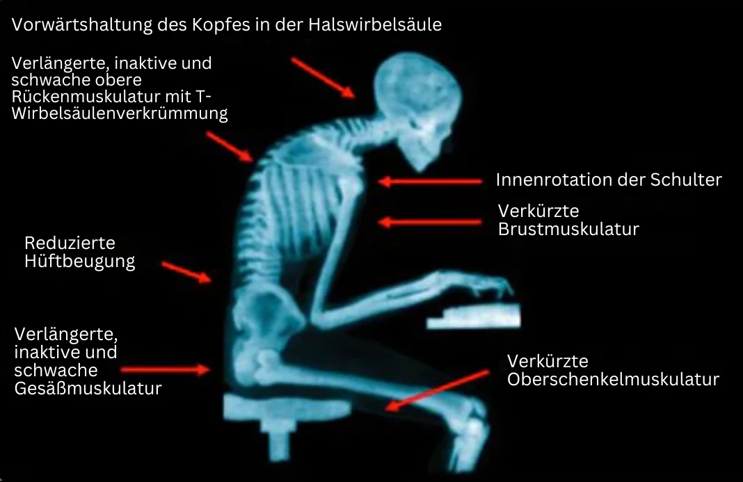 Houdingsband voor Dames en Heren - PosturePro - Image 3